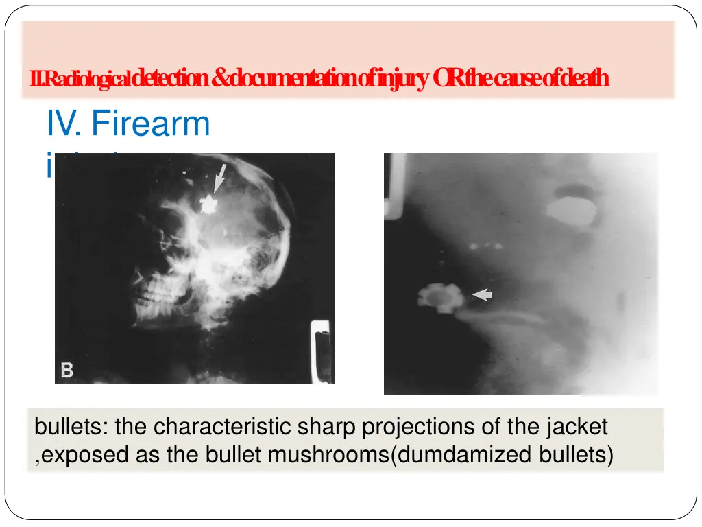 ii radiological detection documentation of injury 9