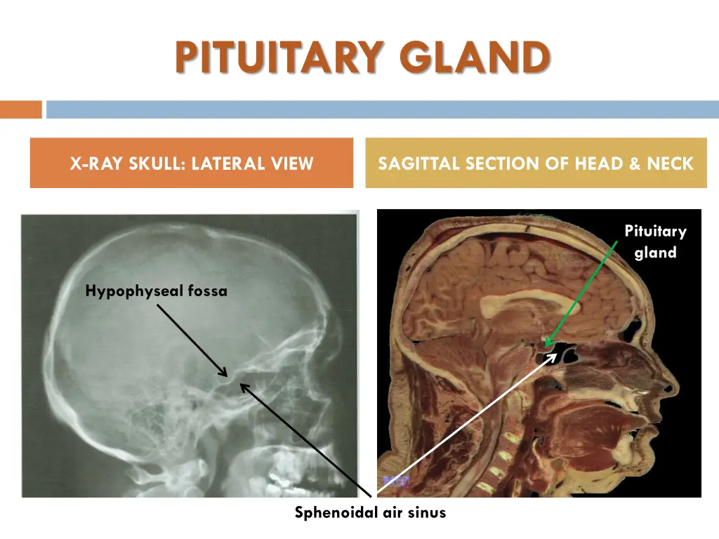 pituitary gland