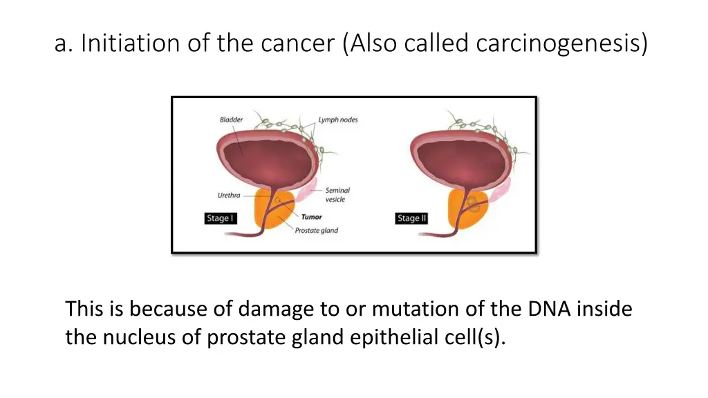 a initiation of the cancer also called