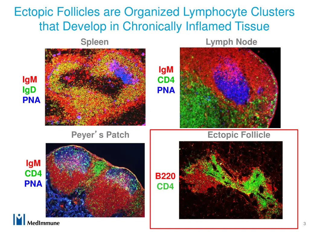 ectopic follicles are organized lymphocyte