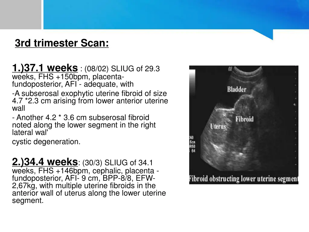 3rd trimester scan