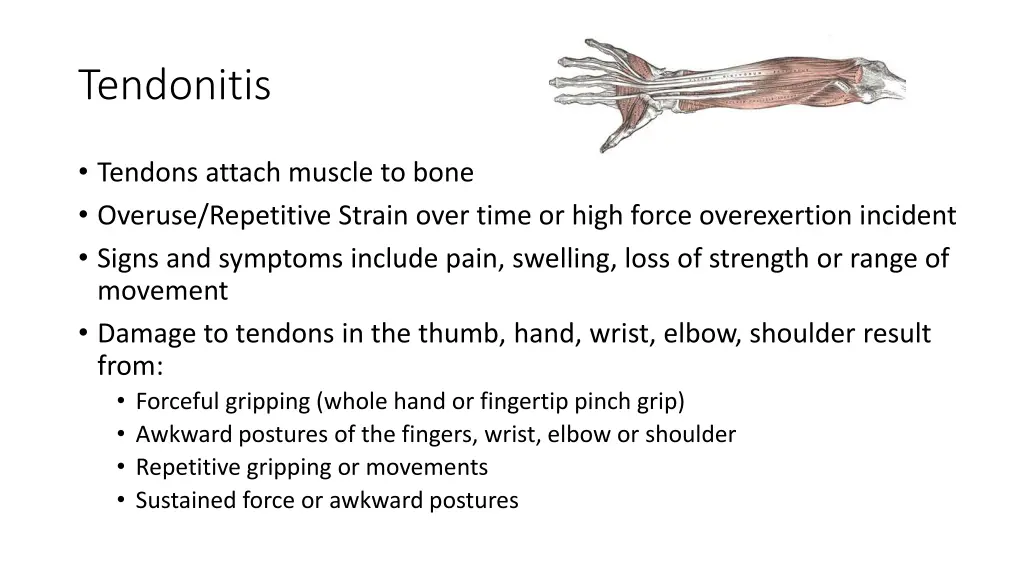 tendonitis