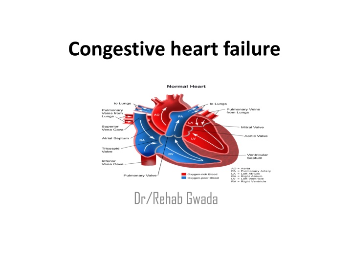 congestive heart failure