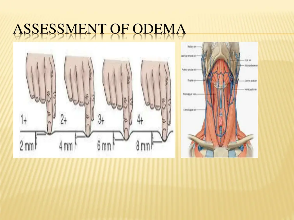 assessment of odema