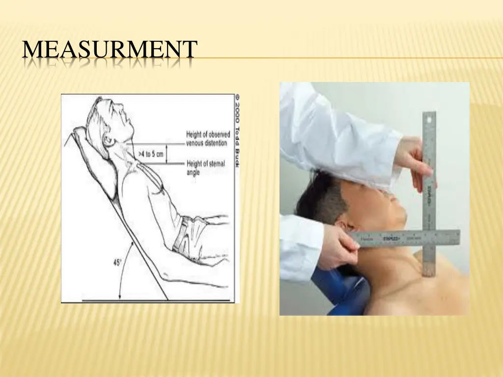 measurment