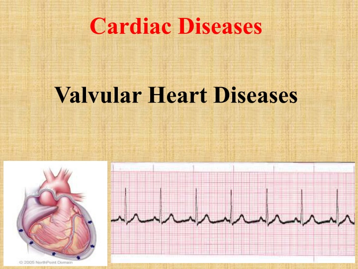 cardiac diseases