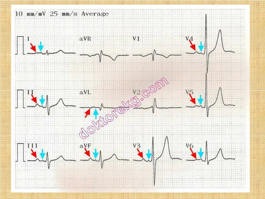 slide15