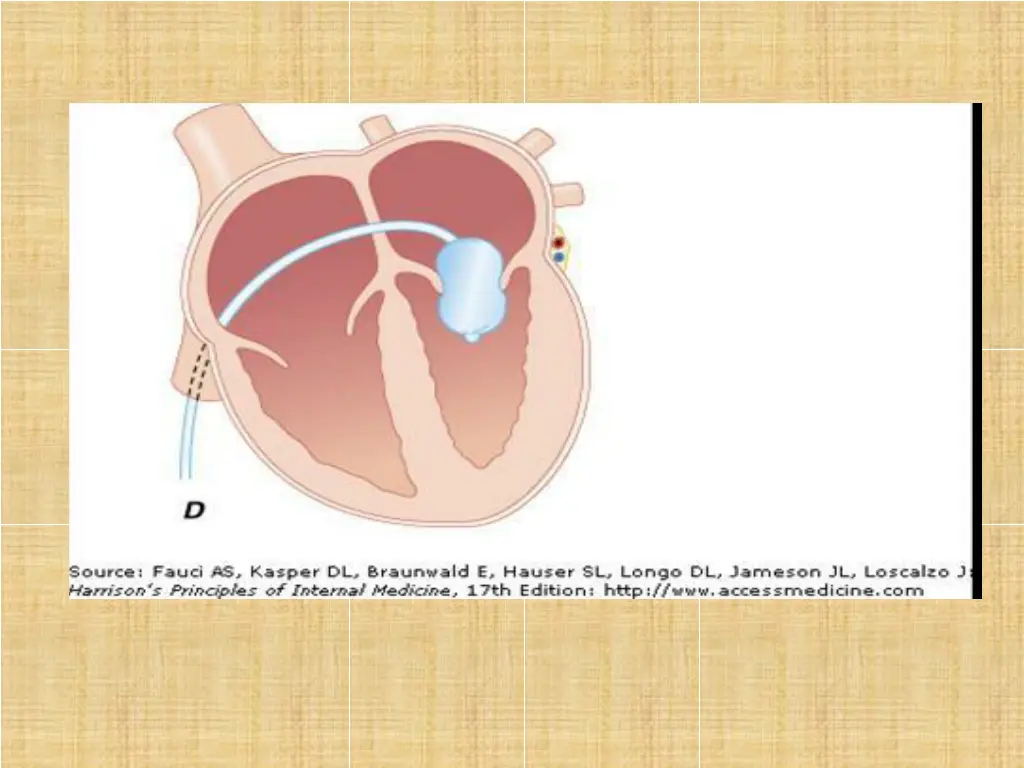 slide19