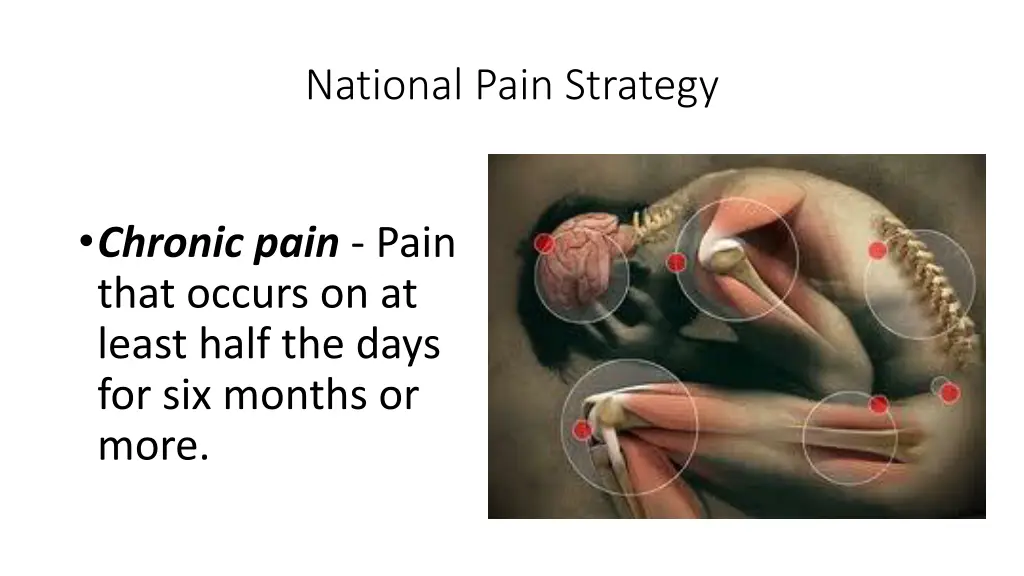 national pain strategy