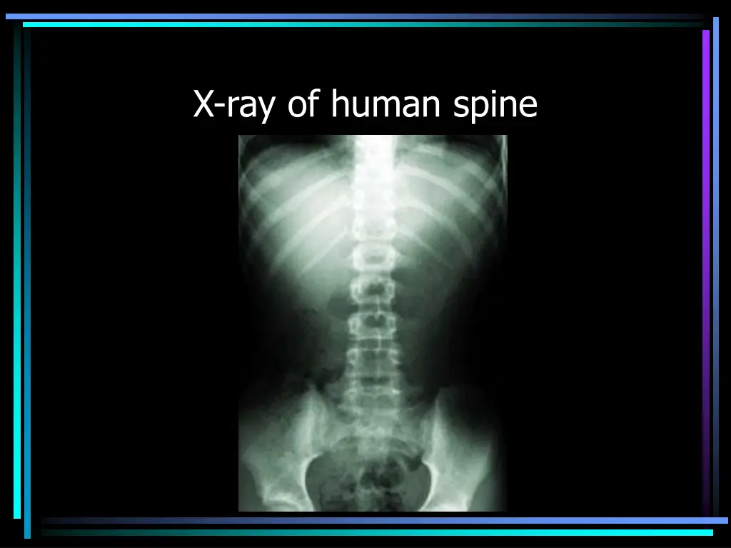 x ray of human spine