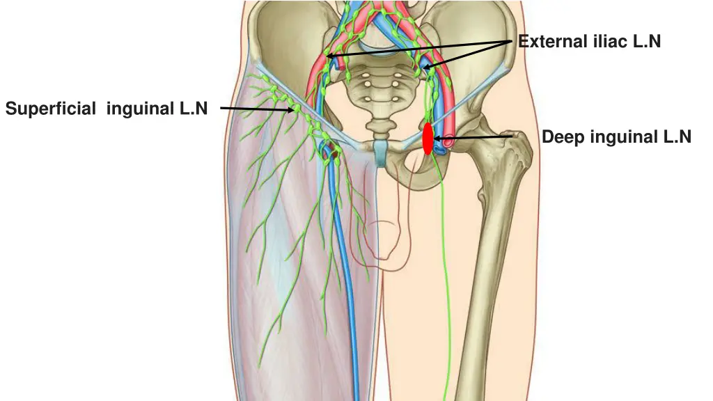 external iliac l n