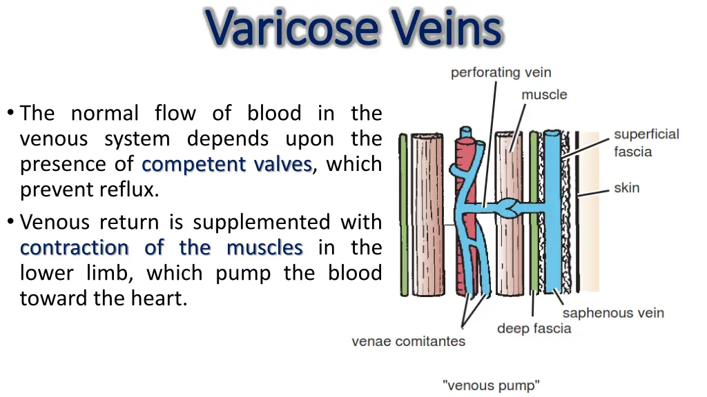 varicose veins varicose veins