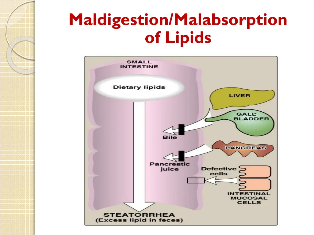 maldigestion malabsorption of lipids