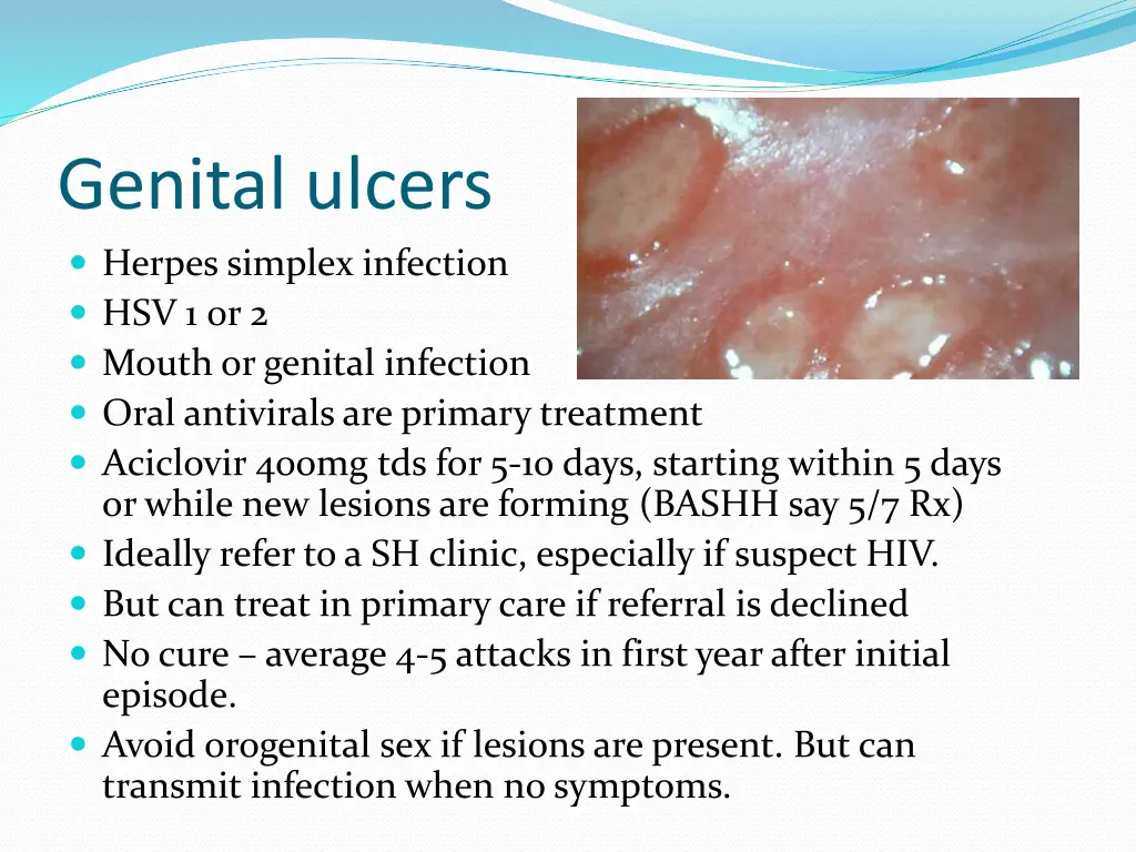 genital ulcers herpes simplex infection