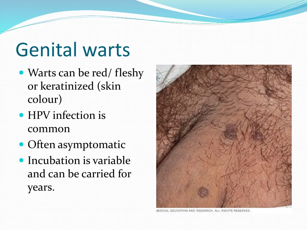 genital warts