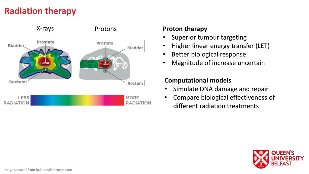 radiation therapy