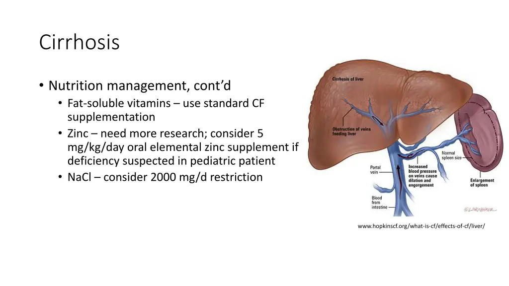 cirrhosis 1