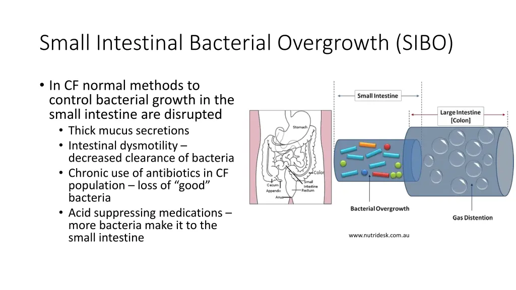 small intestinal bacterial overgrowth sibo