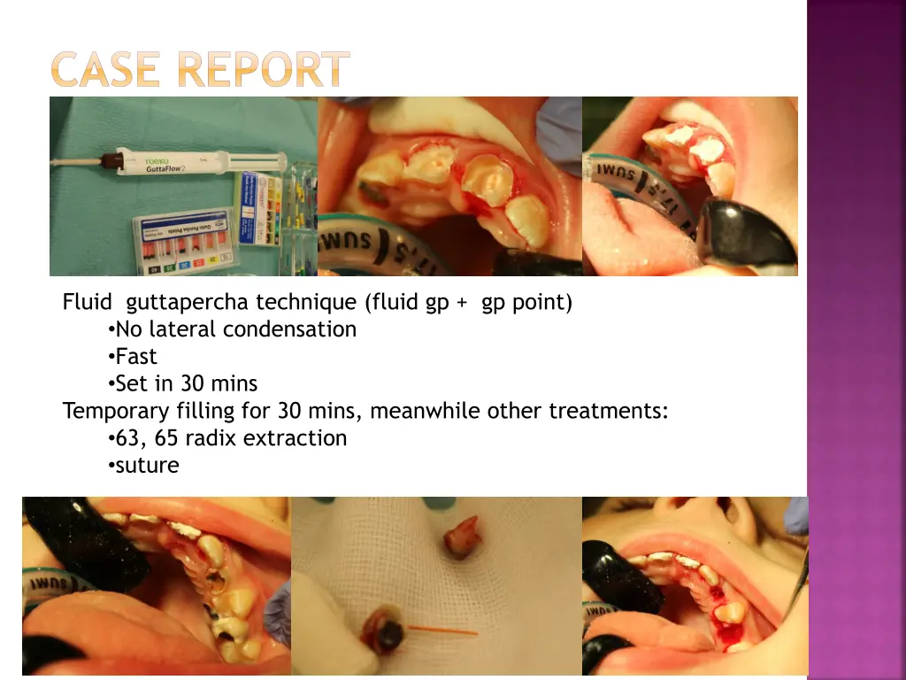 case report 1