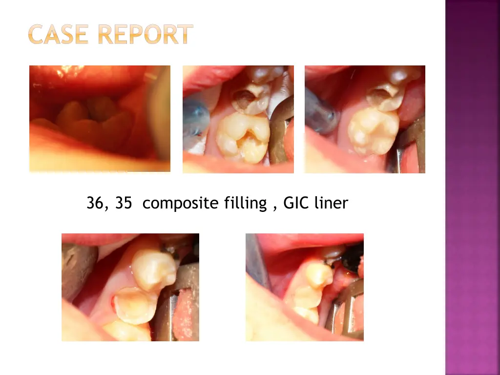 case report 2