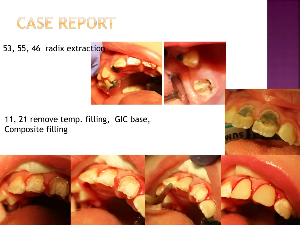 case report 3