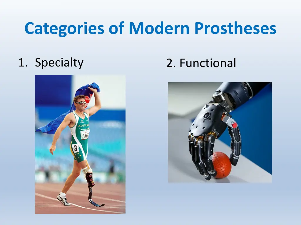 categories of modern prostheses