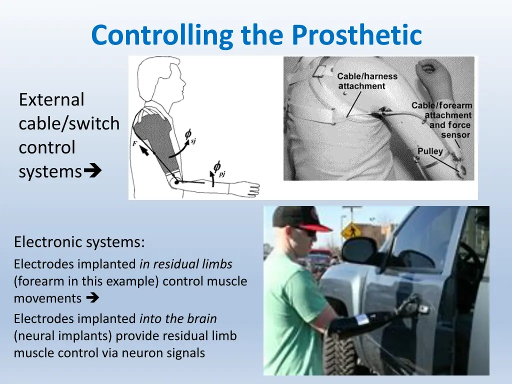 controlling the prosthetic