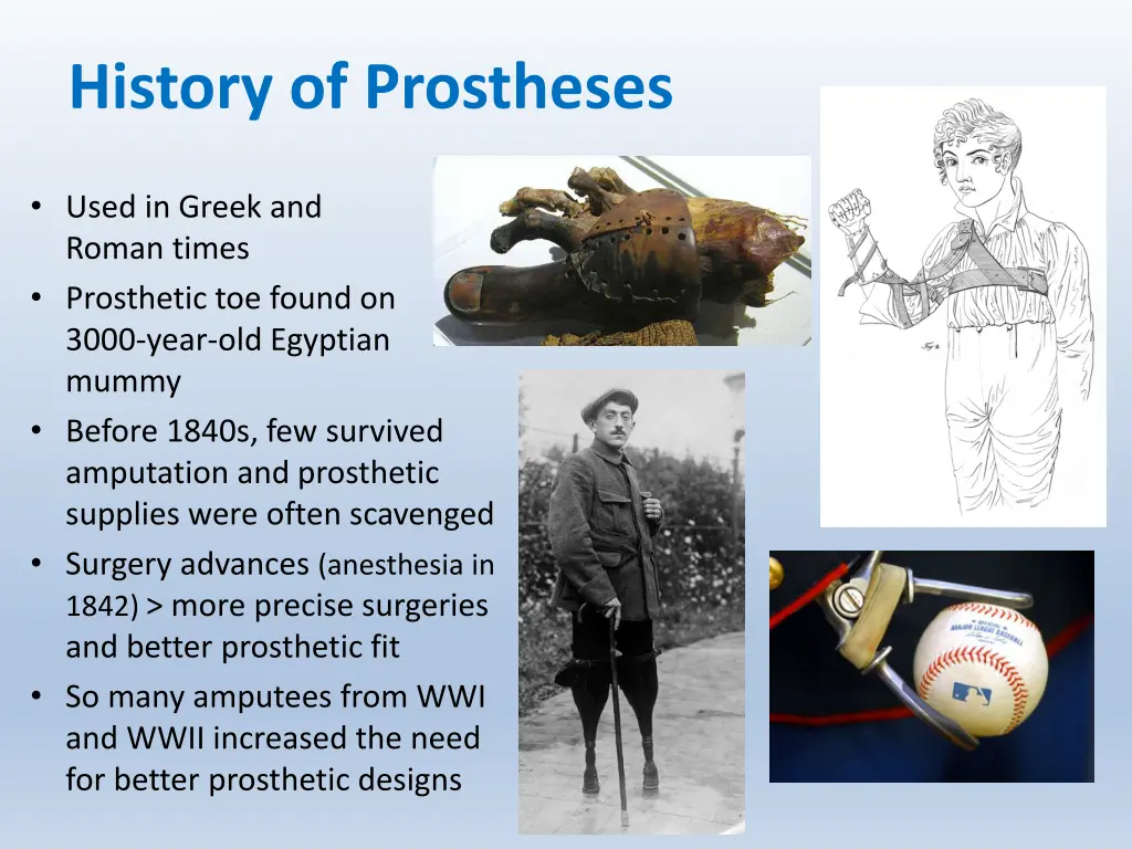 history of prostheses