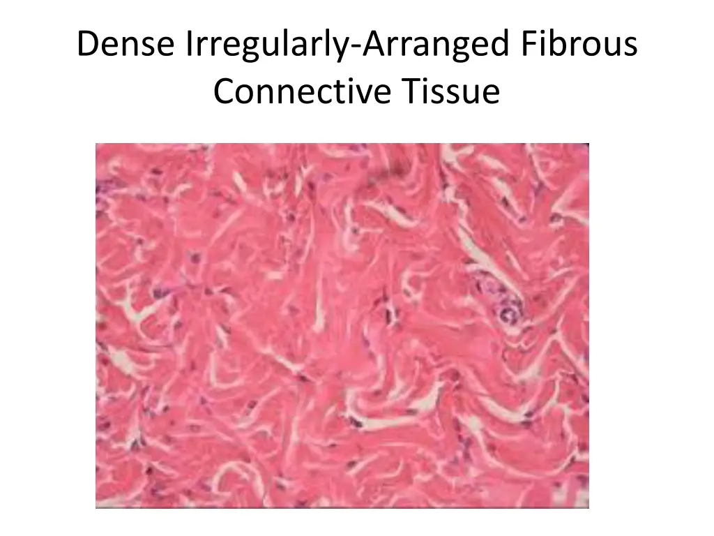 dense irregularly arranged fibrous connective