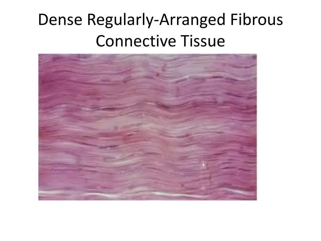 dense regularly arranged fibrous connective tissue