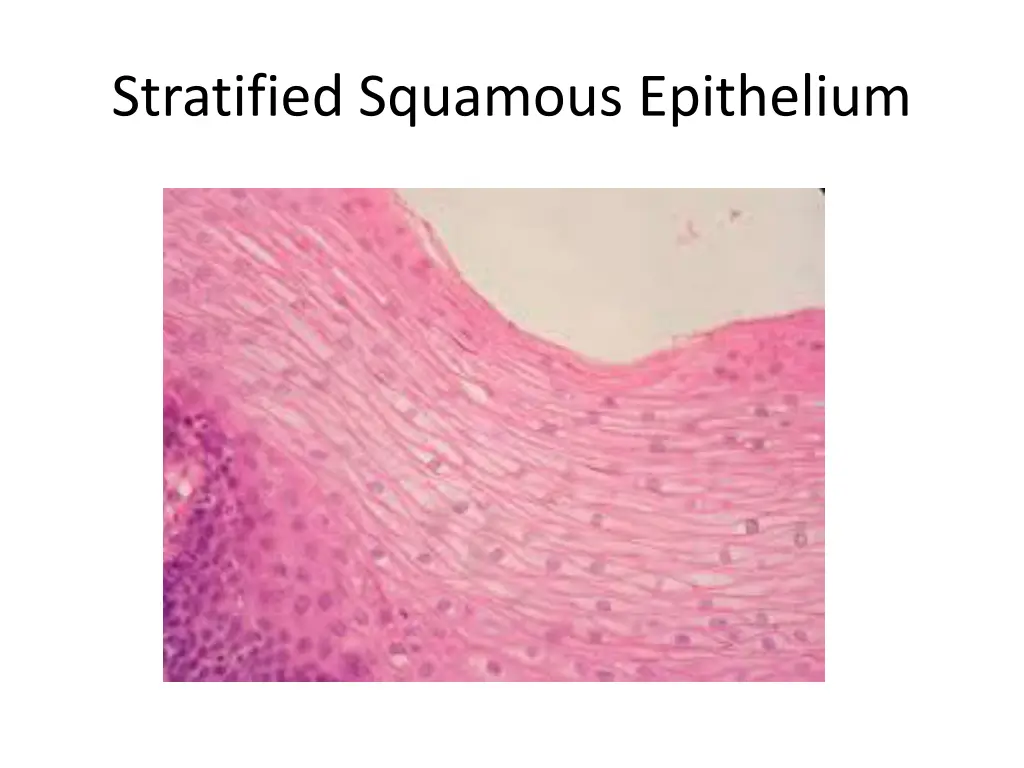 stratified squamous epithelium