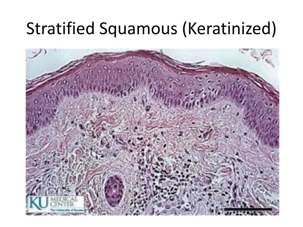 stratified squamous keratinized