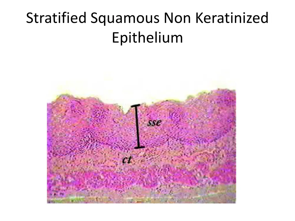 stratified squamous non keratinized epithelium