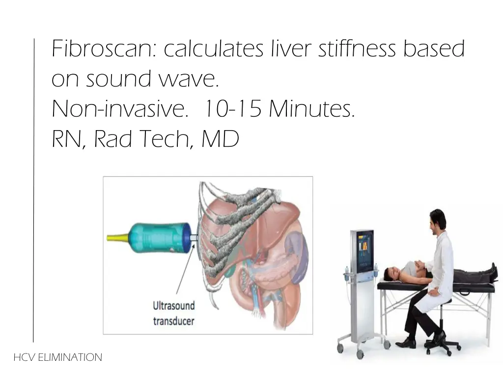 fibroscan calculates liver stiffness based