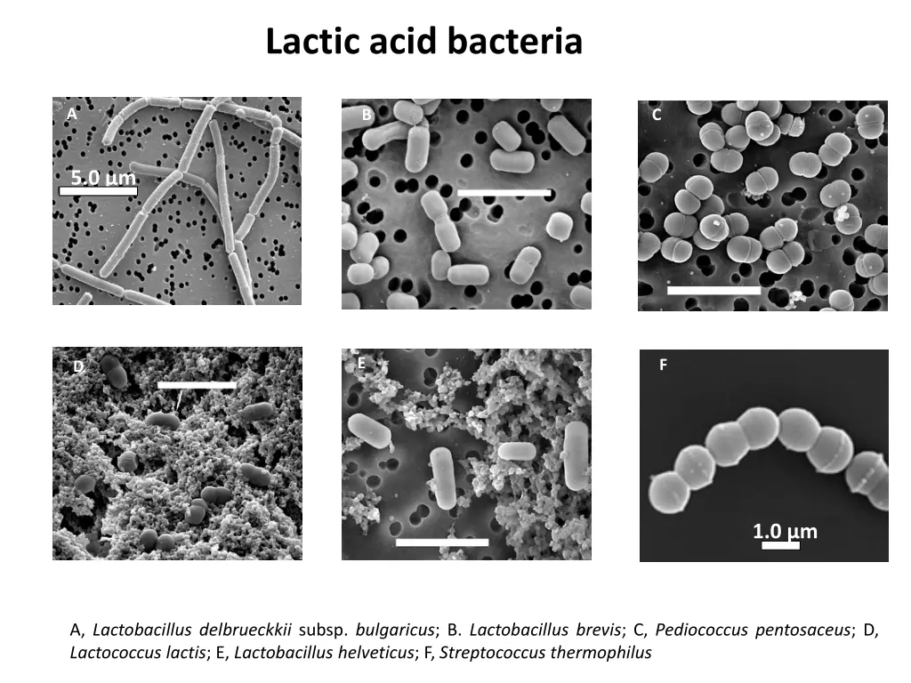 lactic acid bacteria