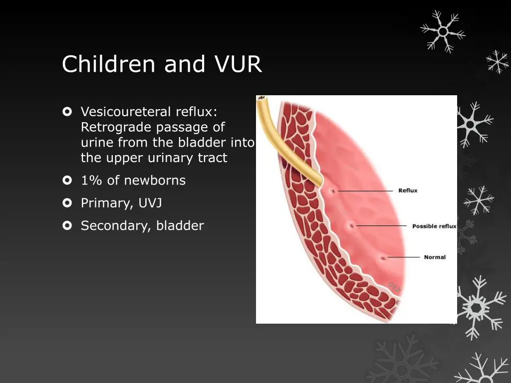 children and vur