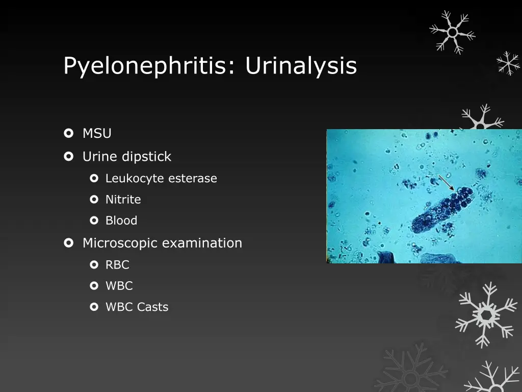 pyelonephritis urinalysis