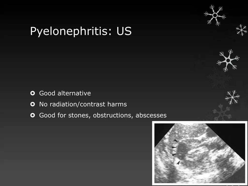 pyelonephritis us