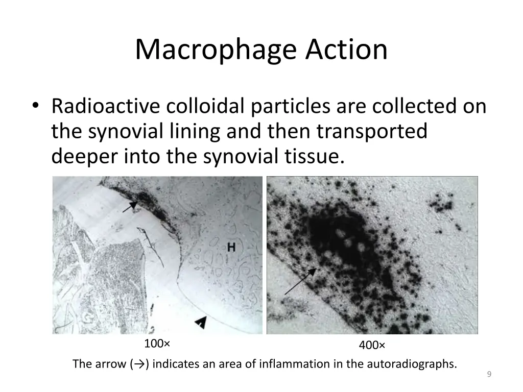 macrophage action