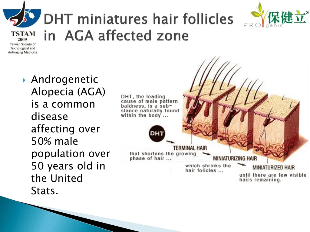 androgenetic alopecia aga is a common disease