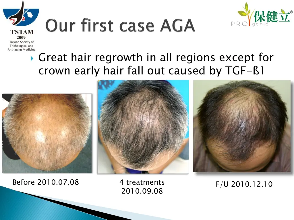 great hair regrowth in all regions except