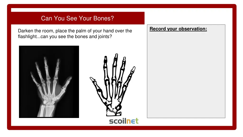 can you see your bones