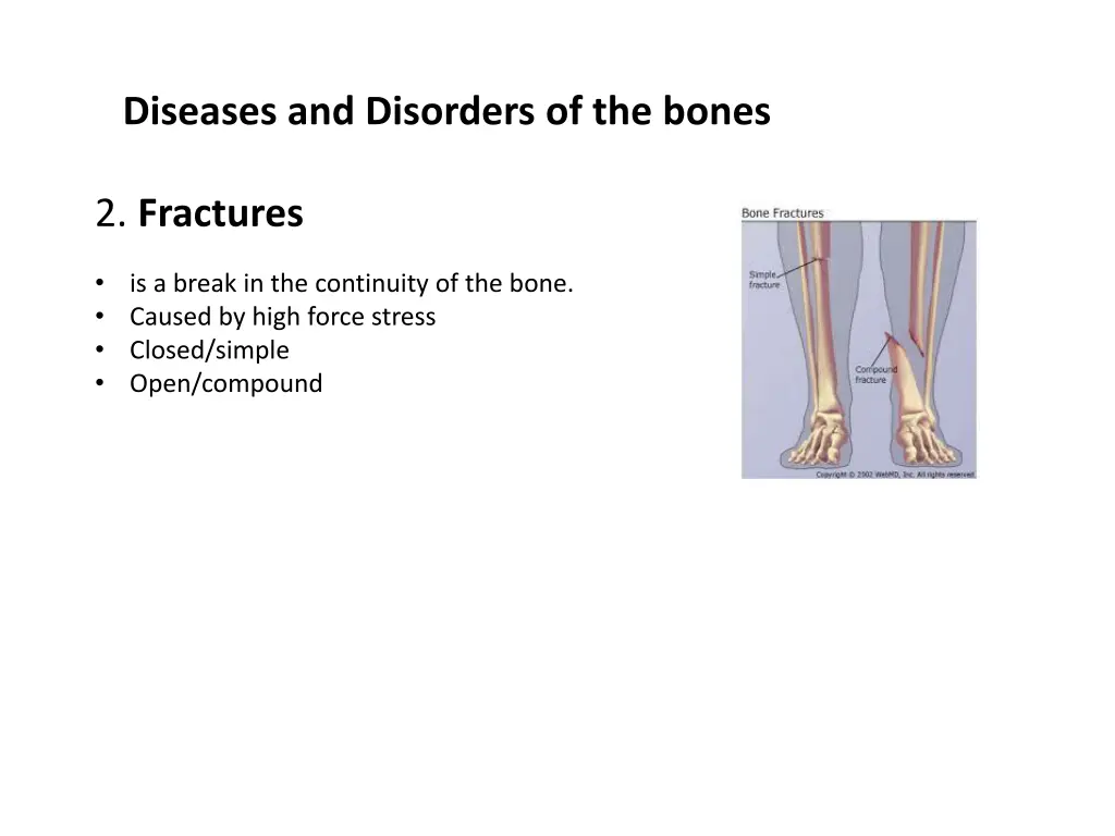 diseases and disorders of the bones 1