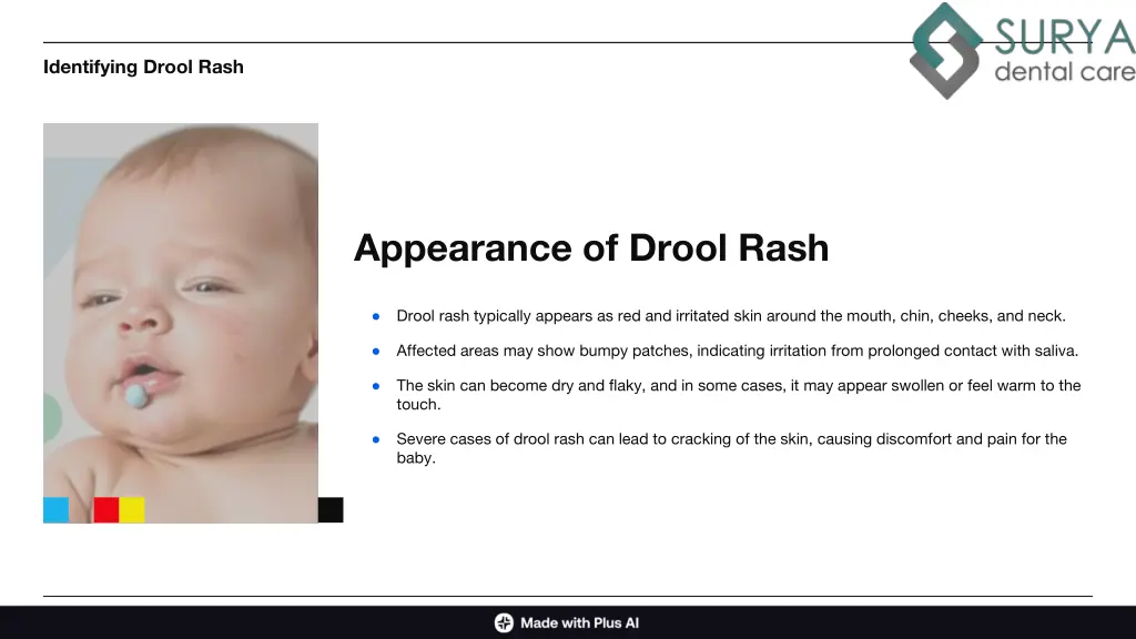 identifying drool rash