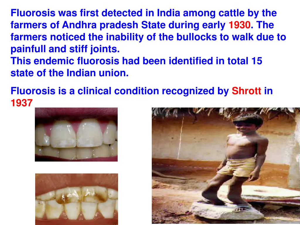 fluorosis was first detected in india among