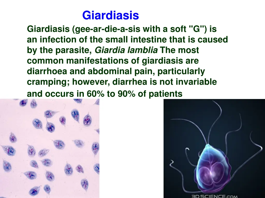 giardiasis