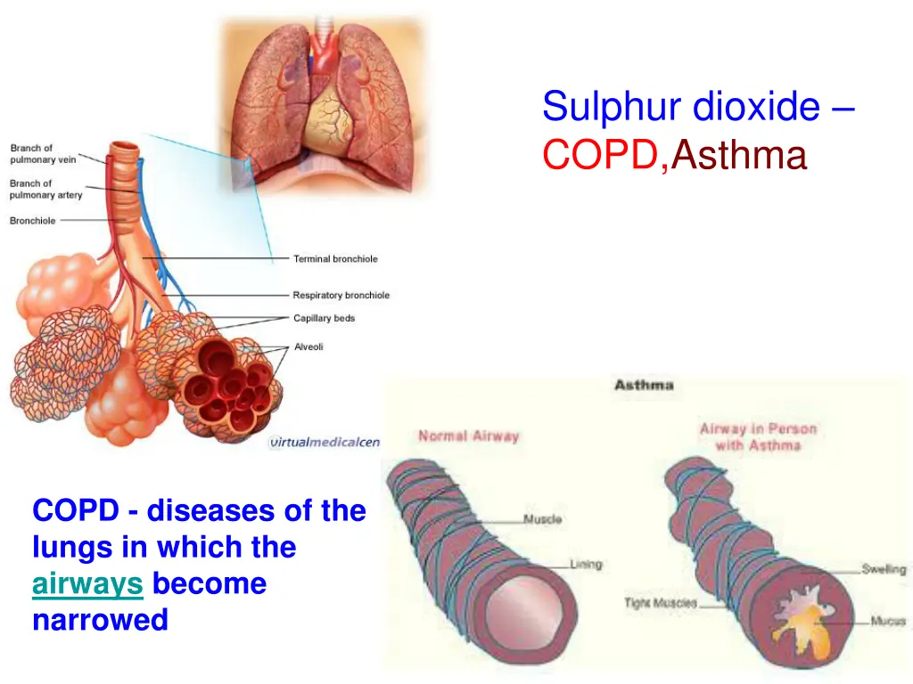 sulphur dioxide copd asthma