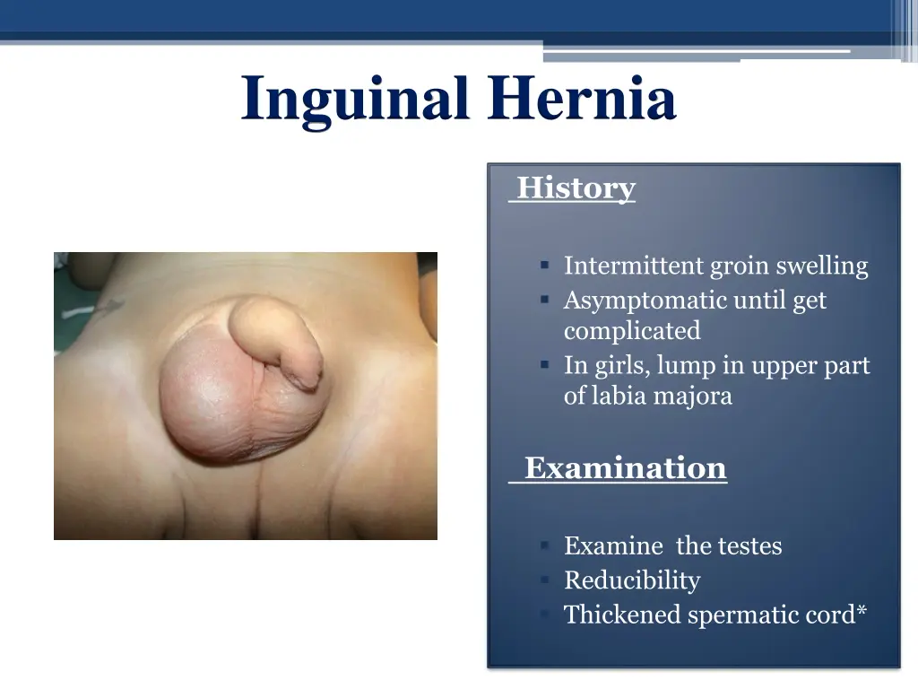 inguinal hernia 1