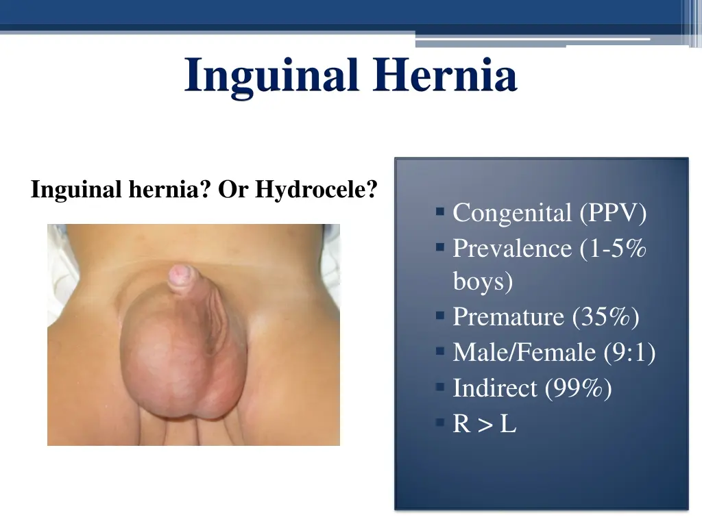 inguinal hernia