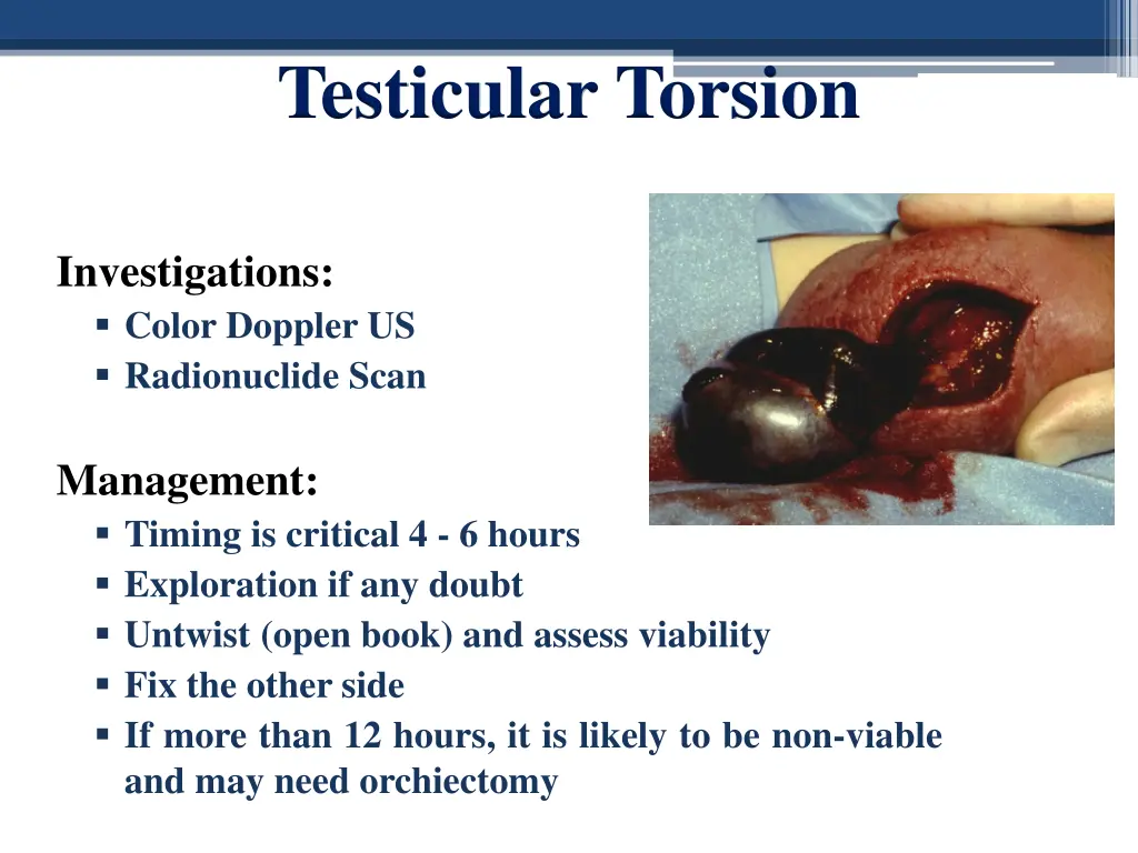 testicular torsion 1